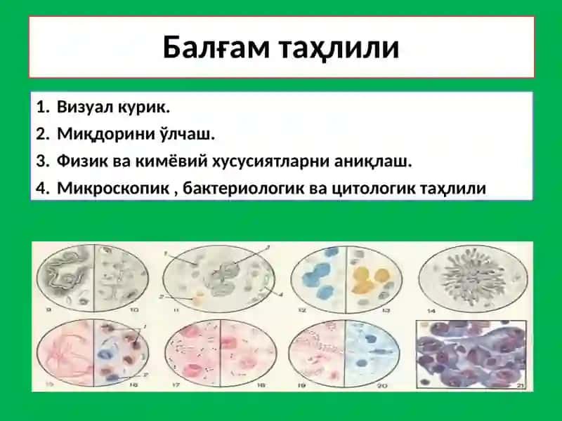 Balg‘am va plevra suyuqligini laborator tekshirish. 4