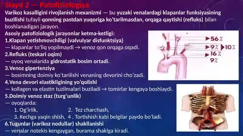 Oyoq venalarining varikoz kasalligida bajariladigan operatsiyalar. 4
