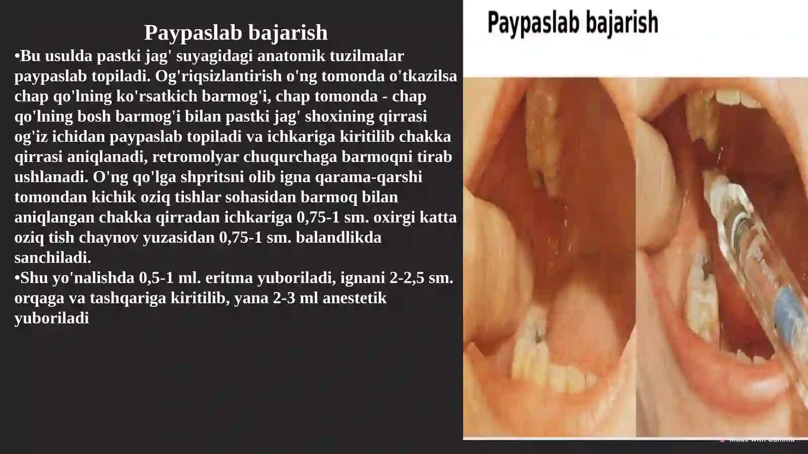 Stomatologiyada patstki jagʻda oʻtkaziladigan oʻrinsizlantirish haqida 4