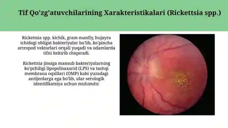 Riketsiozlar: toshmali tif, Ku- isitmasi qo'zgatuvchilarining xarakteristikasi va diagnostikasi 4