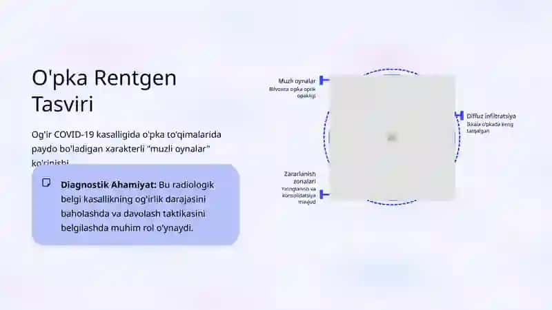 COVID-19: Klinik Belgilari va Davolash Tamoyillari 4