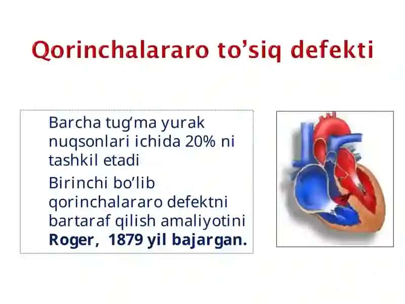 Tug‘ma yurak nuqsonlari embronal davirdagi rivojlanishdagi buzilishlar 4