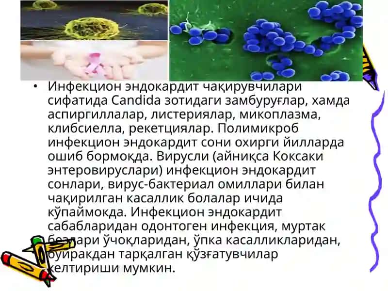 Бактериал септик эндокардит 4