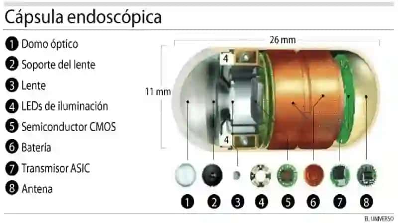 Muqobil – kapsula endoskopiyasi 4