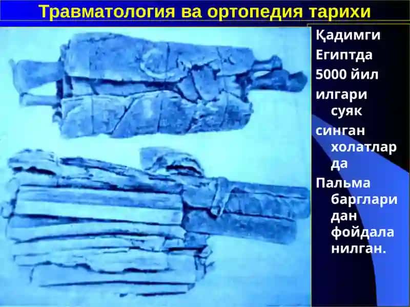 Травматология ва ортопедия 4