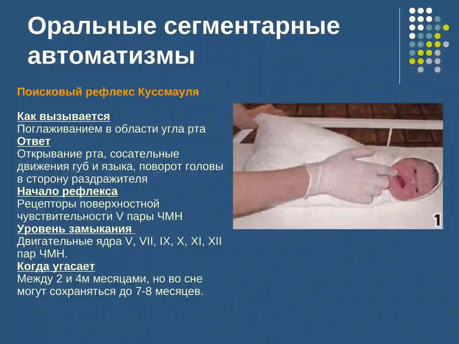 Рефлексы новорожденных и детей первого года жизни 4