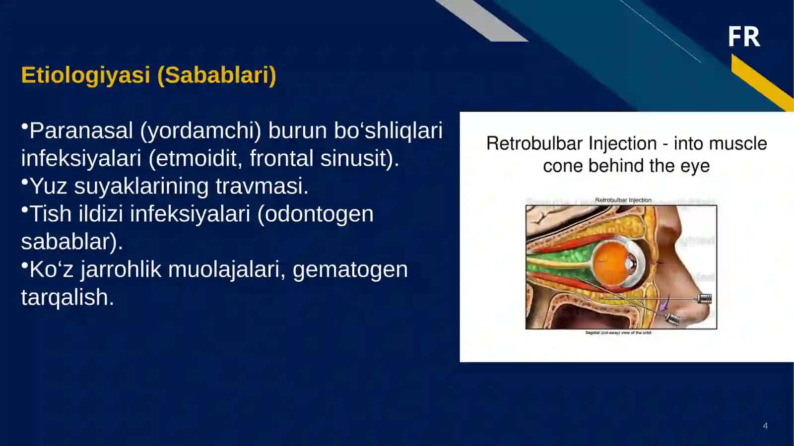 Retrobulbarabsess 4