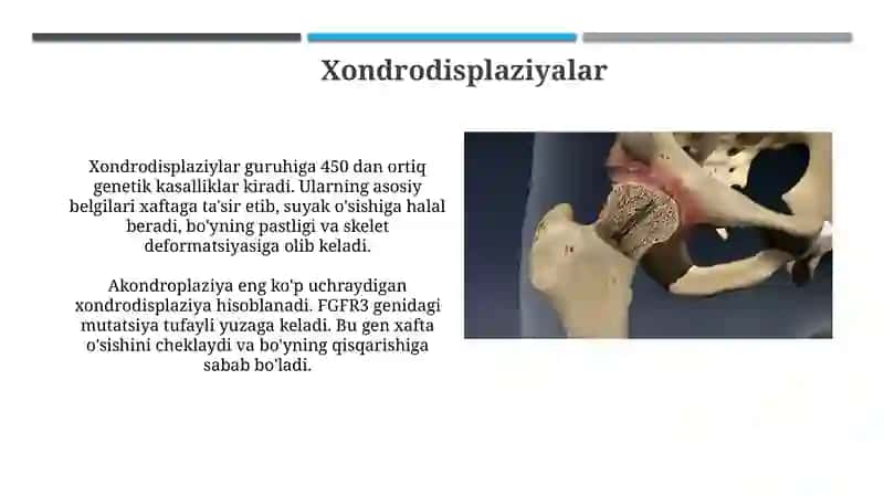 Suyaklarni rivojlanishini buzilishlari 4