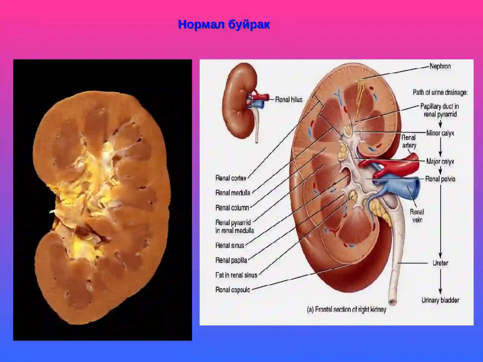 PATOLOGIK ANATOMIYa FANIDAN MA’RUZA 4