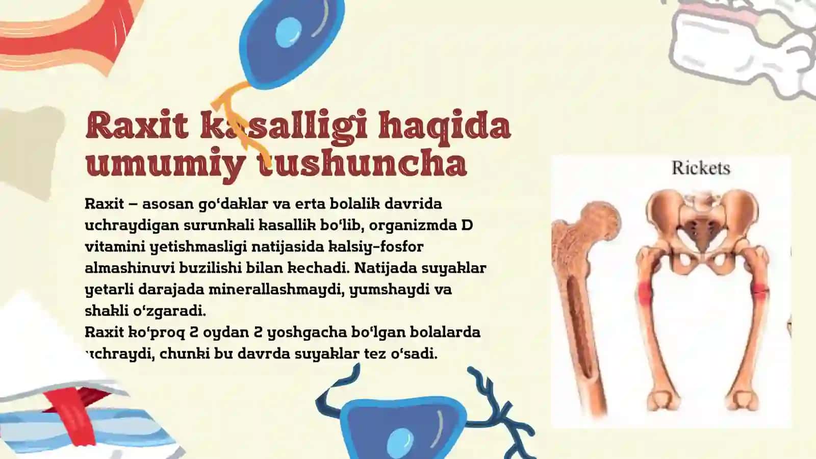 Raxit kasalligi 4