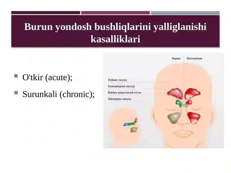 Otorinolaringologiyada shoshilinch Holatlar 4