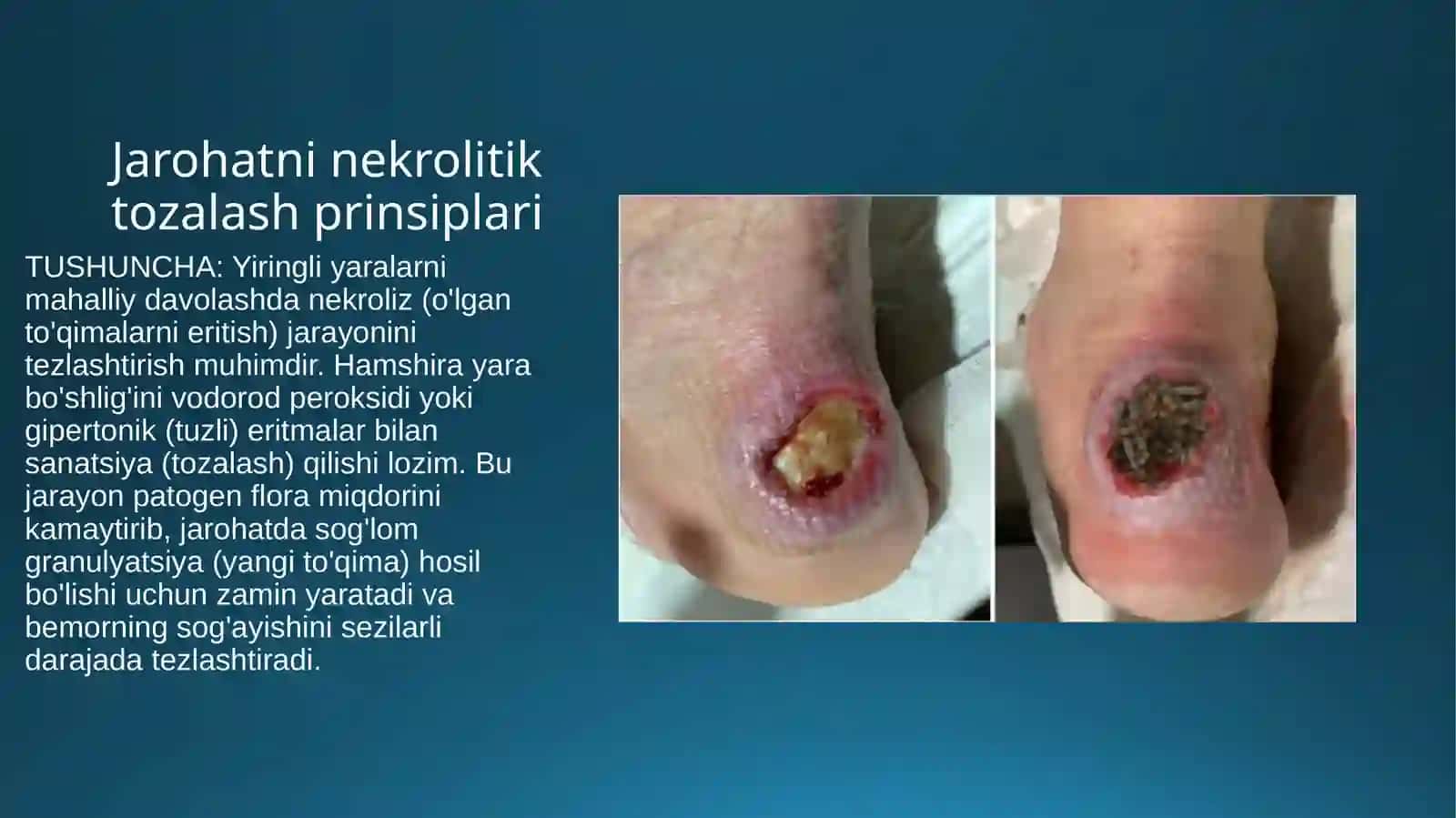 yiringli xirurgik bemorlar parvarishi 4