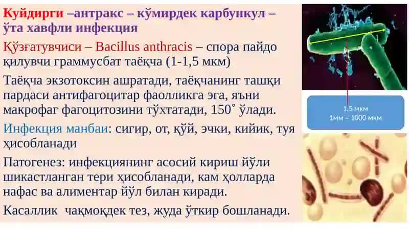 Ўта хавфли инфекциялар, геморрагик иситма. Куйдирги. Ўлат. ВАБО эпидемиология, этиология, патогенез ва патологик анатомияси 4