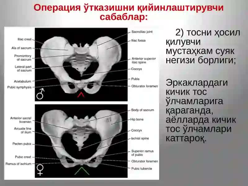 Тос соҳаси топографик  анатомияси. Тос бўшлиғи аъзоларидаги асосий операциялар. 4