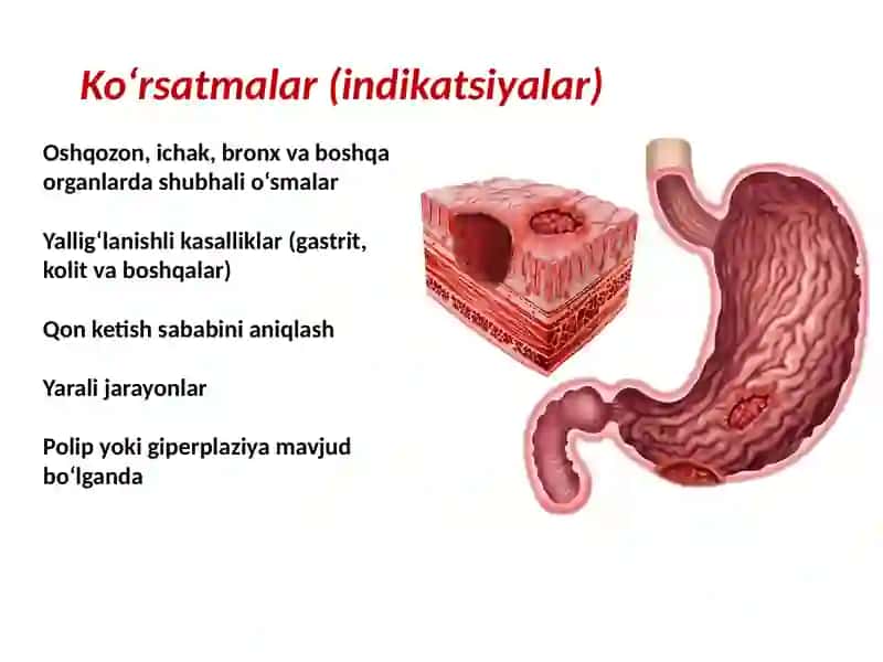 Endoskopik biopsiya 4