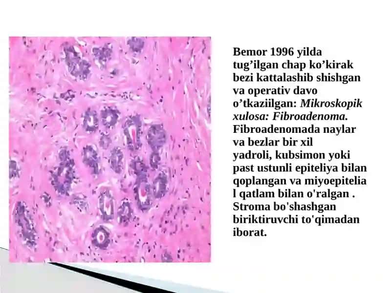 SUT BEZI SARATONI MORFOLOGIYASI VA OLDINI OLISHGA ZAMONAVIY YONDOSHUV 4