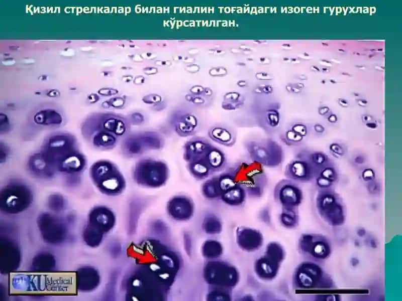Тогай ва суяк тукималар 4