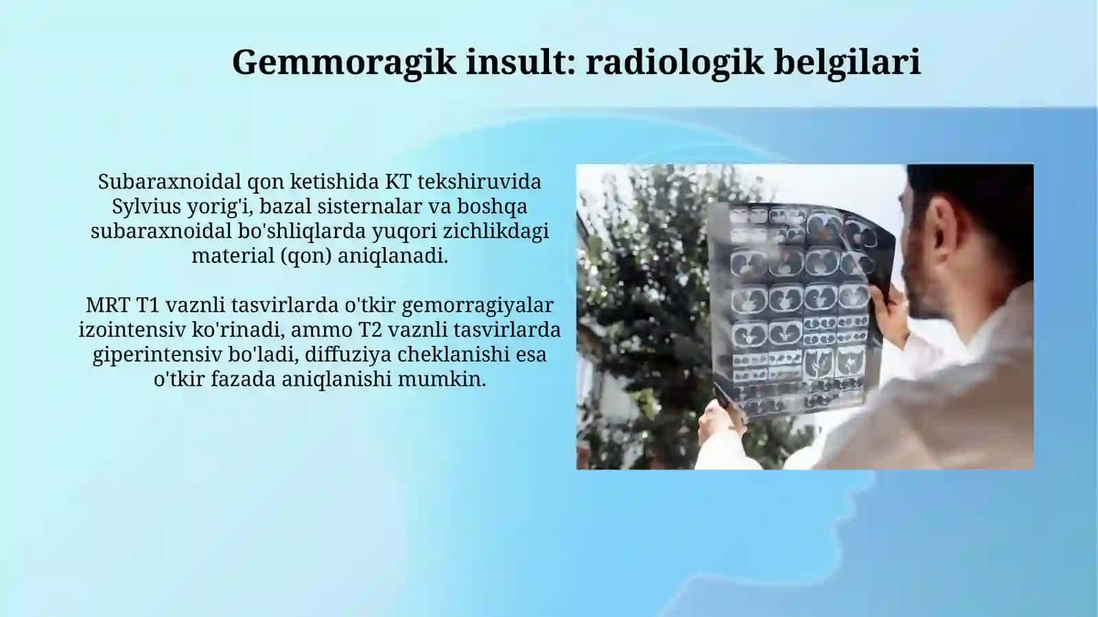 Bosh miyya qon tomir kasalliklari.Radiologiyasi 4
