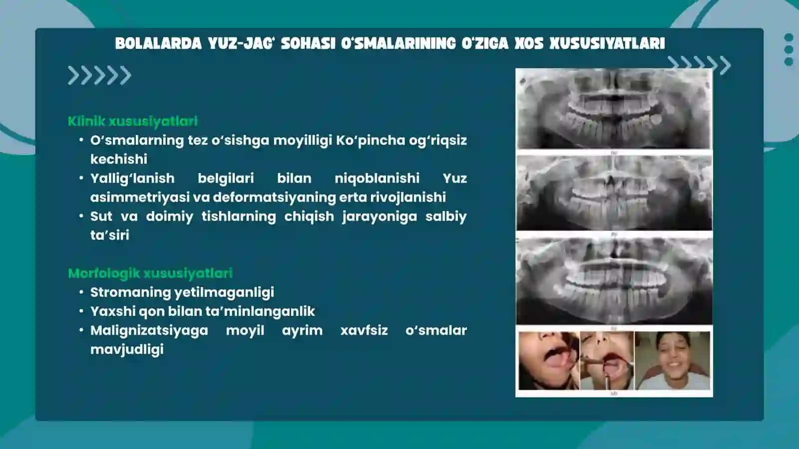 BOLALARDA YUZ-JAG‘ SOHASI O‘SMALARI VA O‘SMASIMON HOSILALAR 4
