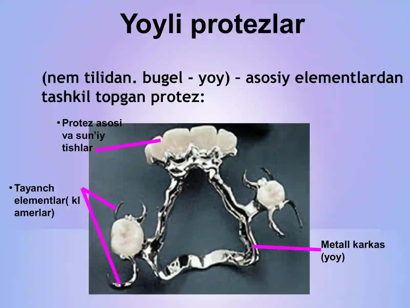 Yoyli protezlar uchun ishlatiladigan klammer turlari 4
