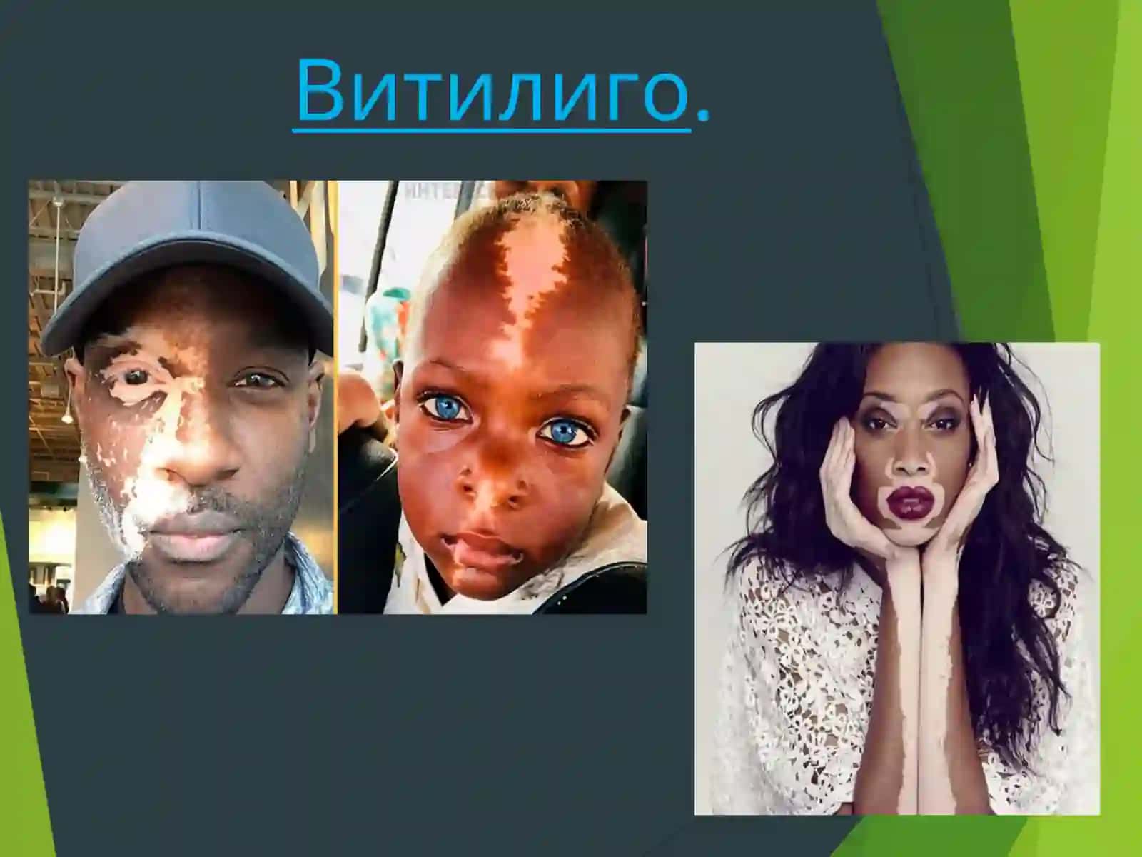 Ожоглар ва тери касалликларида фитотерапия 4