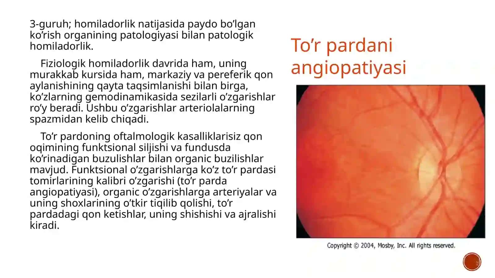 Homilador ayollarda oftalmik holatning klinik xususiyatlari 4