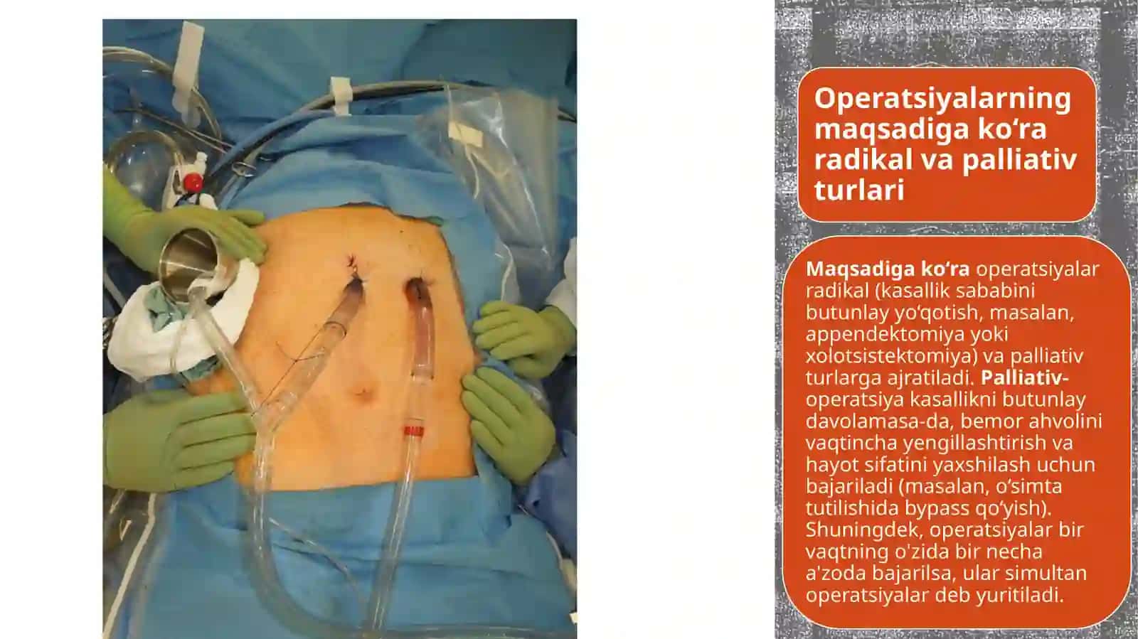 Mavzu: Xirurgik operatsiyat ushunchasi turli operatsiya oldi va operatsiya dan keyingi davrlarda Xirurgik bemorlar parvarishi 4