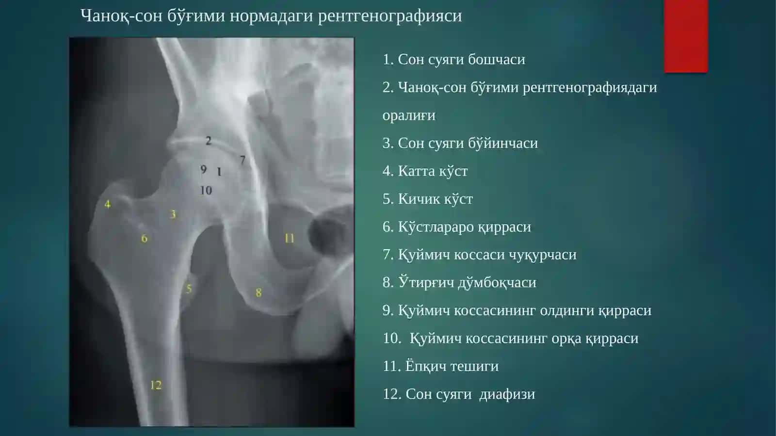 Oyoqning jarohatlari: sonsuyagi, tizzabo‘g‘imi, boldirsuyaklari, oshiqbo‘g‘imi va oyoq panjasi jarohatlari, kelib chiqish sabablari, tashxislash usullari. Davolash prinsiplari 4