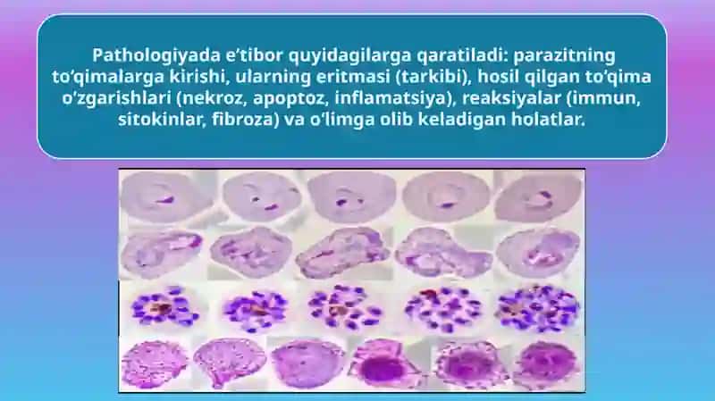 Parazitar infeksiyalar (malyariya,leyshmanioz, amebiaz) 4