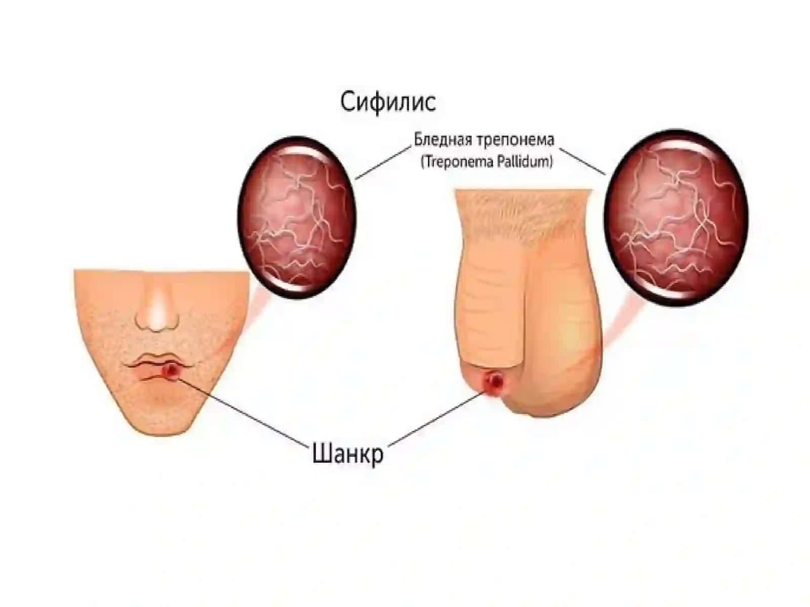 Zaxm diagnostikasi 4