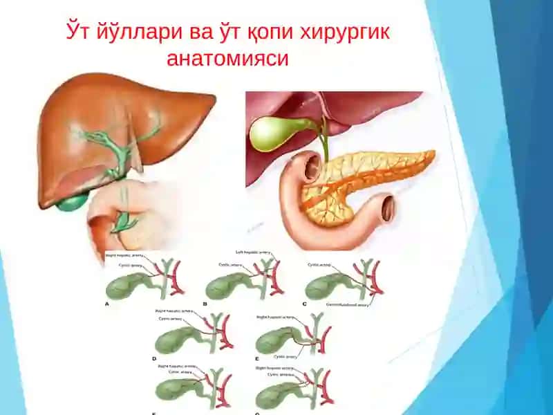 Ўт тош касаллиги 4