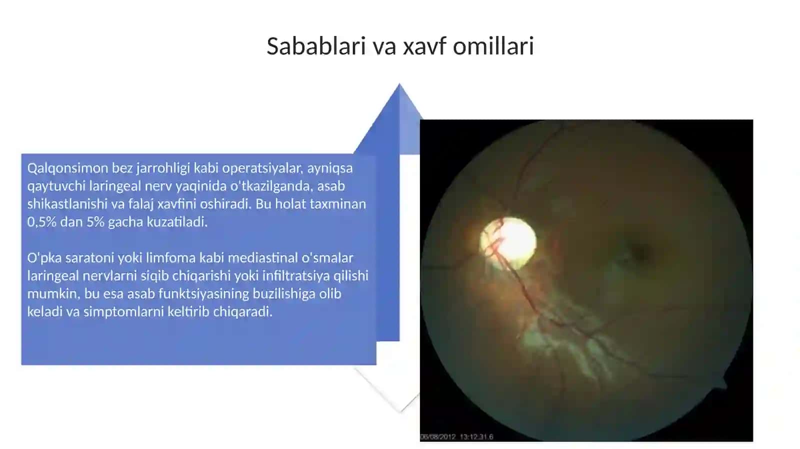 Hiqildoq nervlarining kasalliklari 4