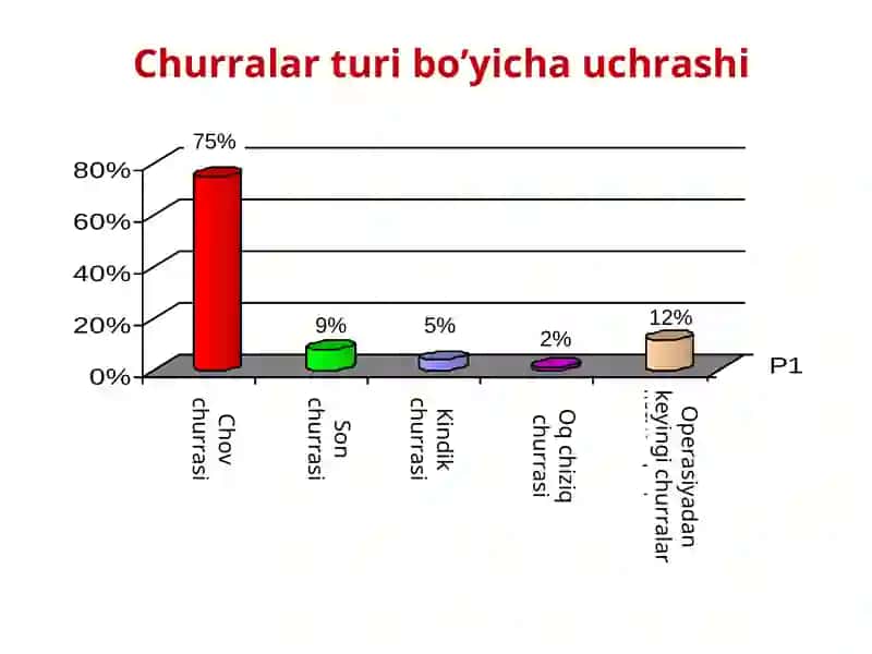 QORIN CHURRALARI 4