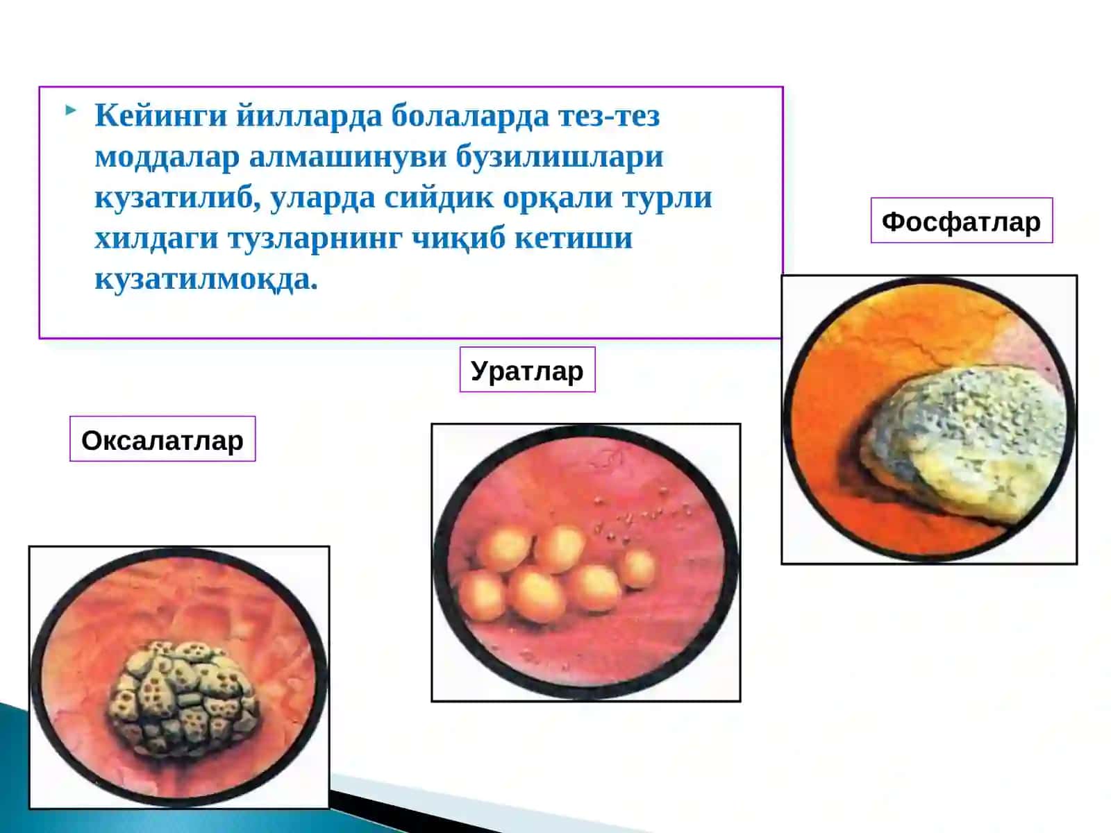 Буйрак касалликлари 4