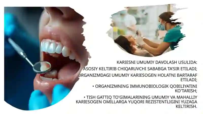 KARIES 4