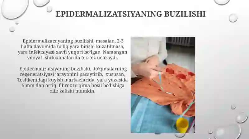 Diagnostika usullari 4