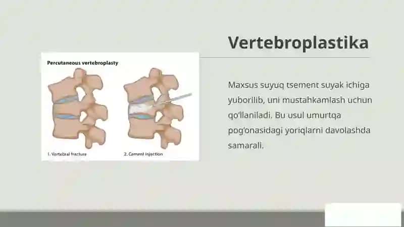 Umurtqapog‘onasi va orqa miyashikastlanishinidavolash 4