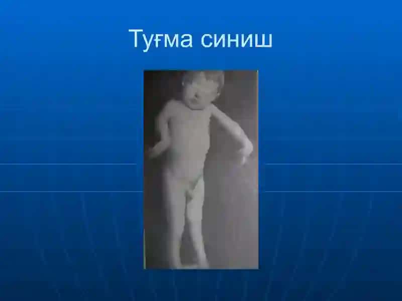 Суякларнинг синиши ва чикиши 4
