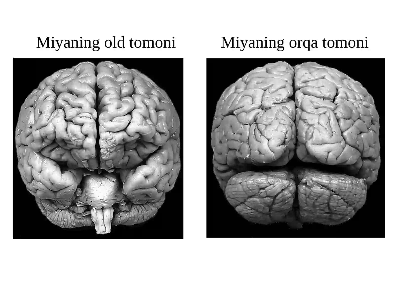 Yosh anatomiyasi va fiziologiyasi - Boshmiyaning tuzilishi 4