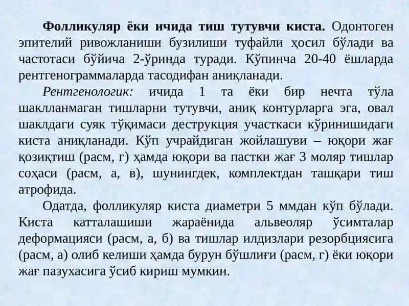 Тиш-жағ соҳаси киста ва ҳосилаларининг нурли диагностикаси 4