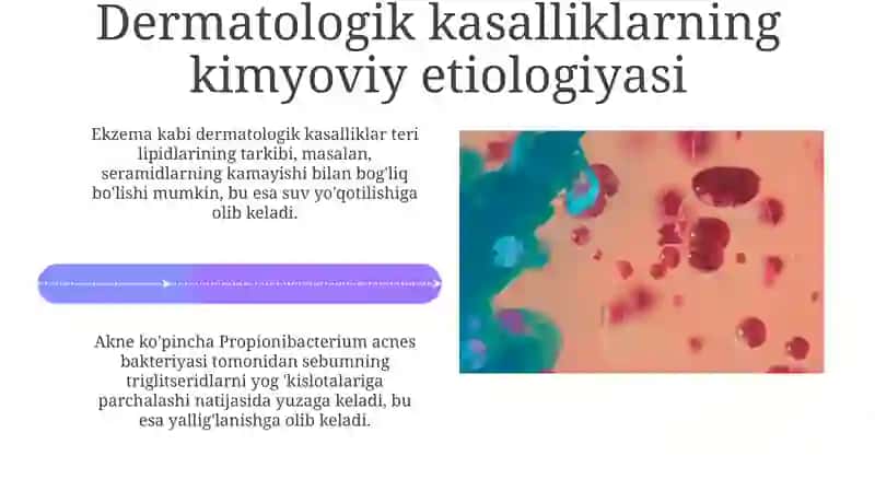 Teri kasalliklarining kimyoviy asoslari 4