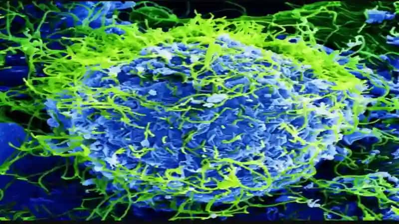 Ebola, Lassa, Zikaviruslari 4