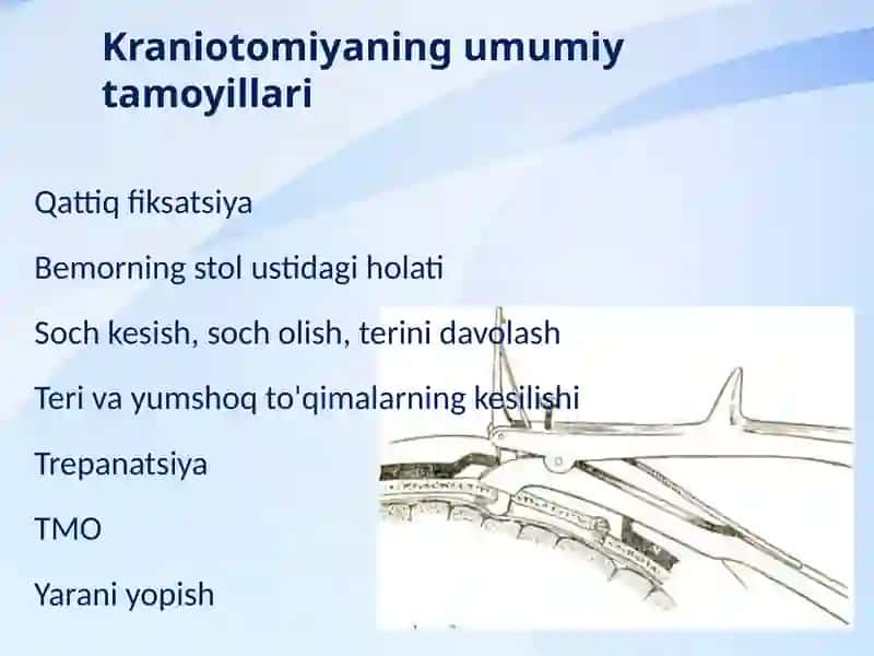 KraniotomiyavaKranioplastika 4