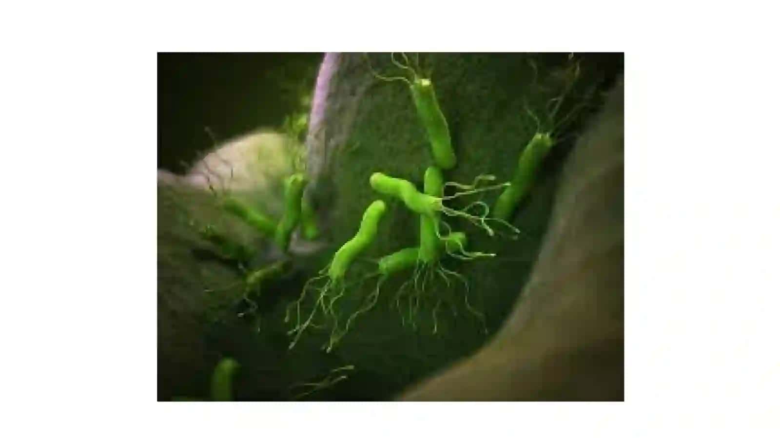 Helicobacter pylori 4