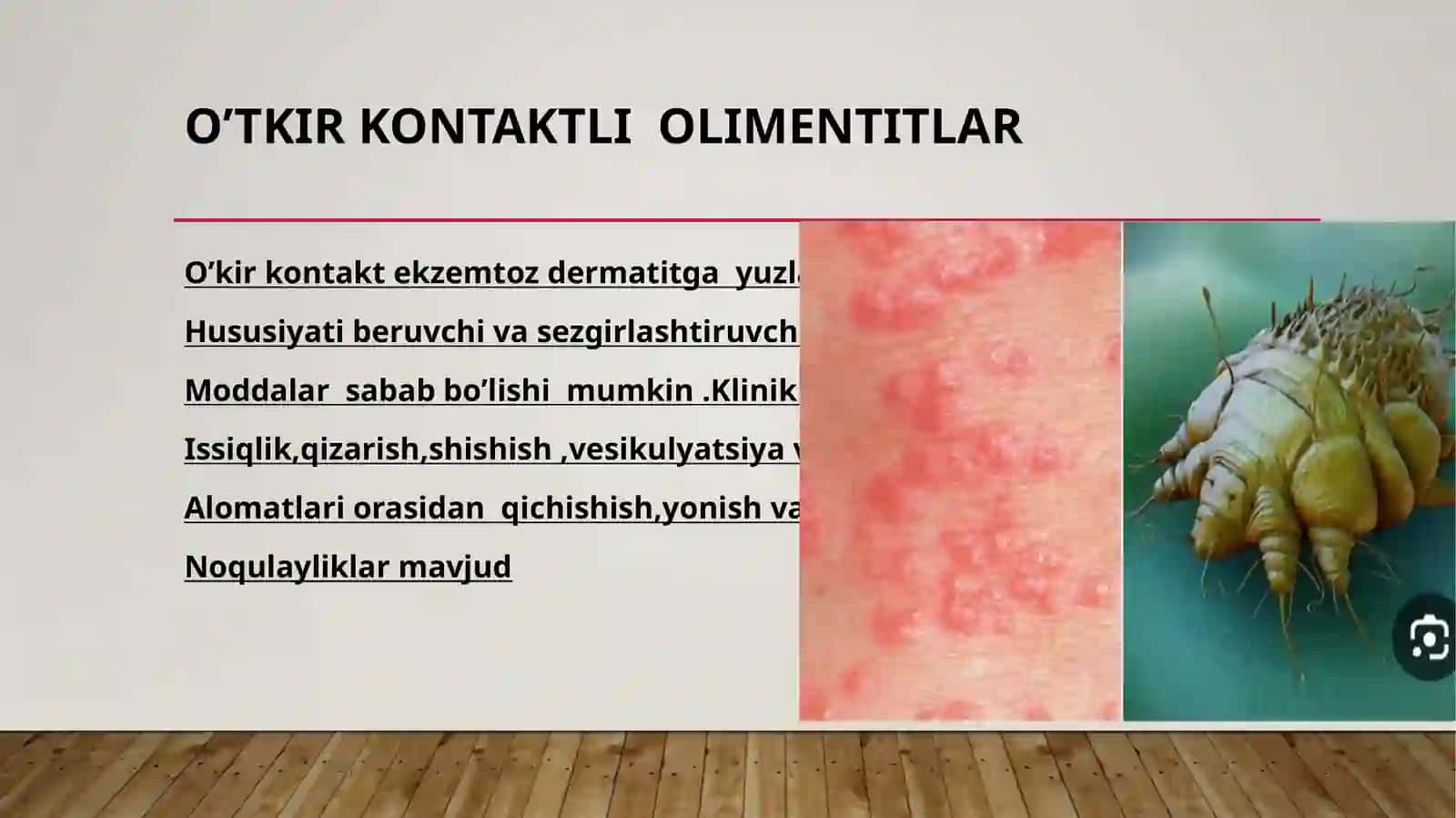 Teri-tanosil kasallik qo'zg'atuvchi va ularni laborator diagnostikasi 4