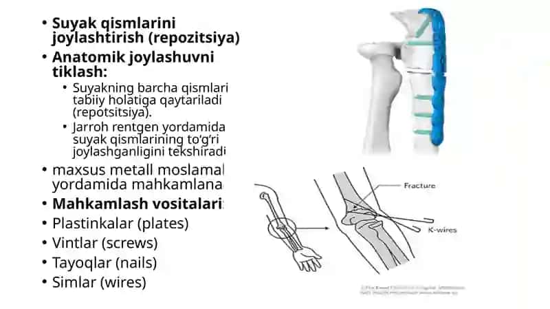 SUYAK SINISHI 4