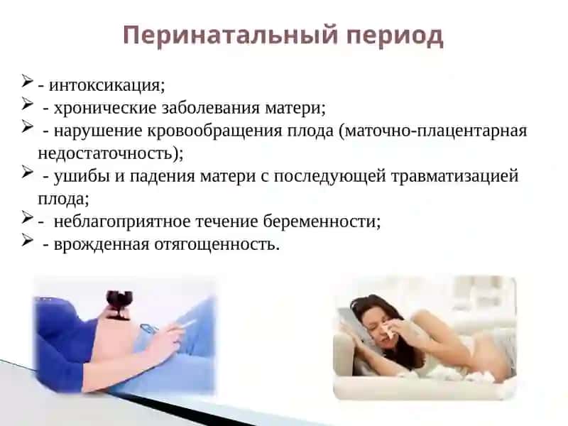 Дефект структуры моторной алалии 4