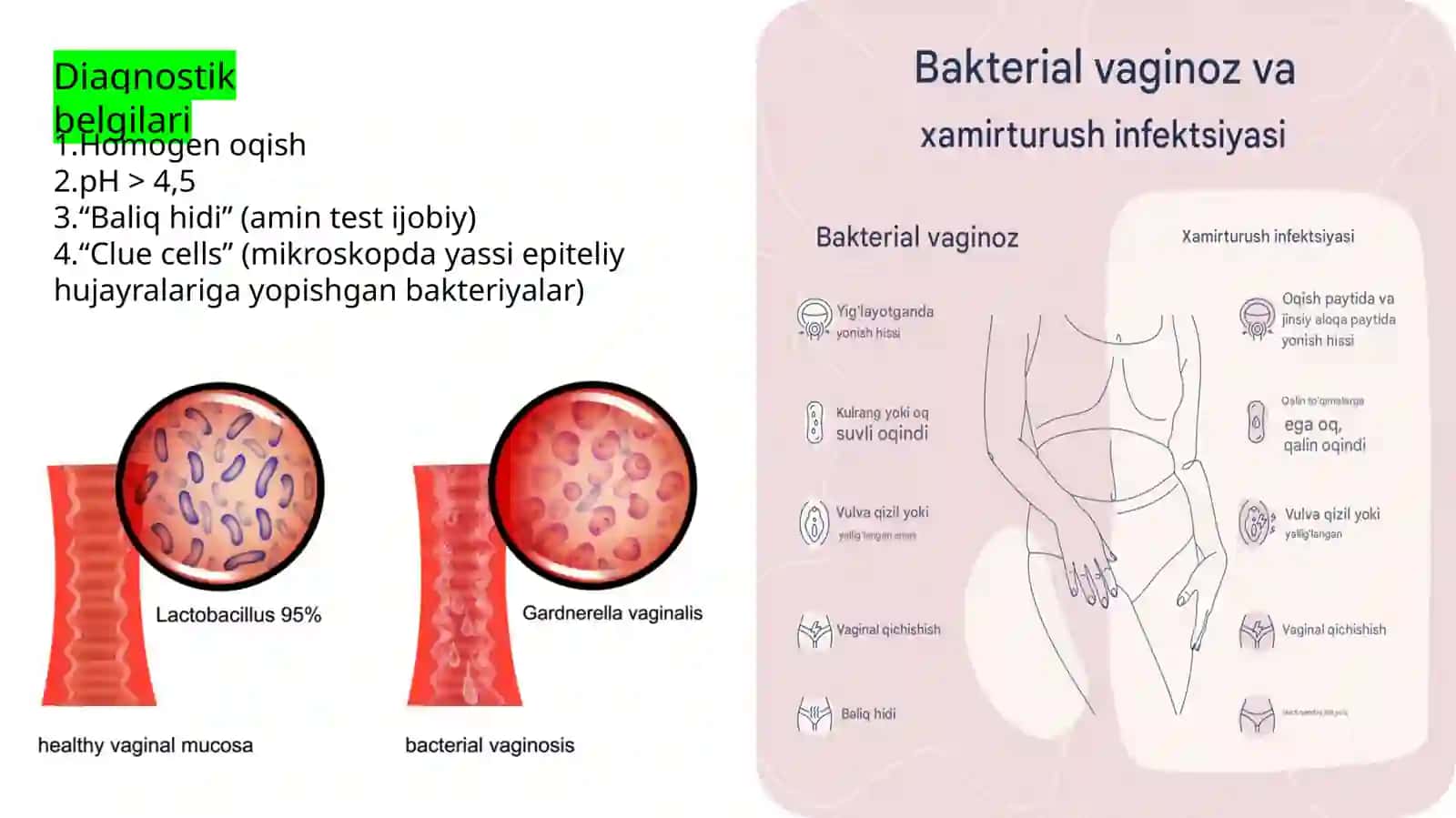 Bakterialvaginoz, Mikoplazmoz, Ureaplazmoz 4
