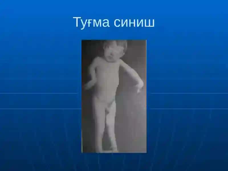 Suyaklarning sinishi va chiqishi 4