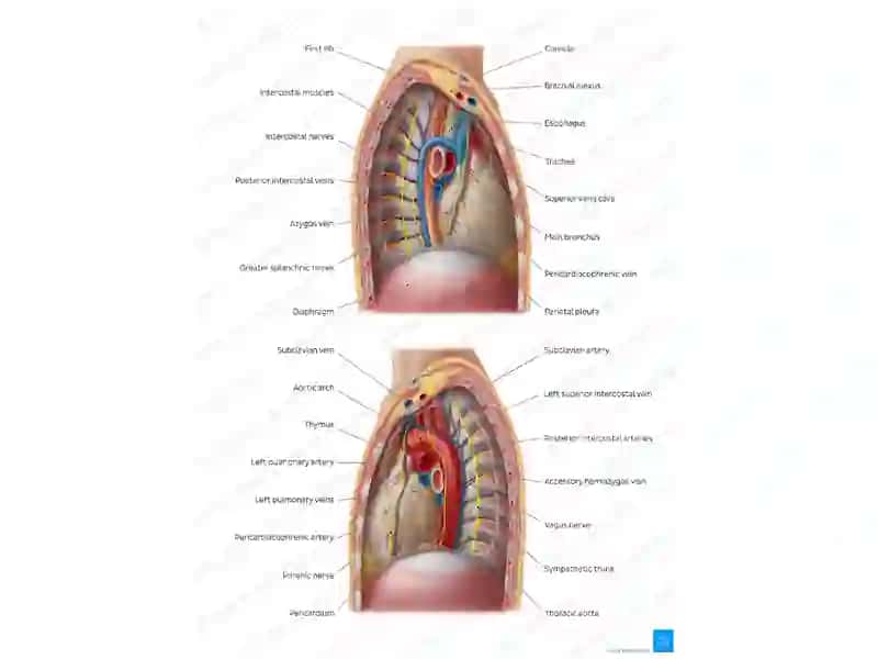 MEDIASTENIT 4